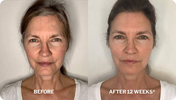 Before and after 12 weeks